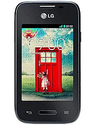 LG&nbsp;L35